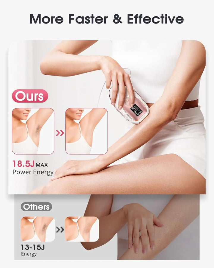 New Multifunction Revolutionary 2024 (Fusion - The Fashion) Hair Removal Ice Cooling Women Men Upgraded 999,900 Flashes 5 Levels Permanent Whole Body Hair Removal Device Laser Epilator for Smooth Skin